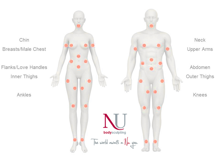 Vaser Body Target Areas