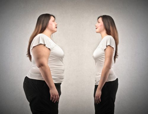 Tried diet & exercise! Is only solution left is Liposuction?